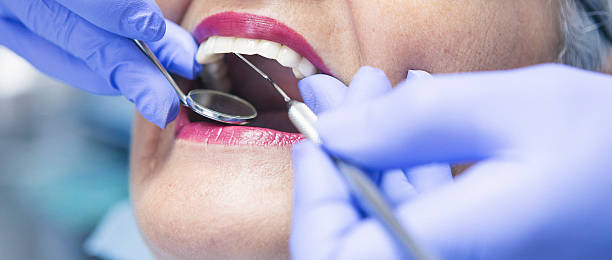 Best Emergency Tooth Extraction in El Paso, IL